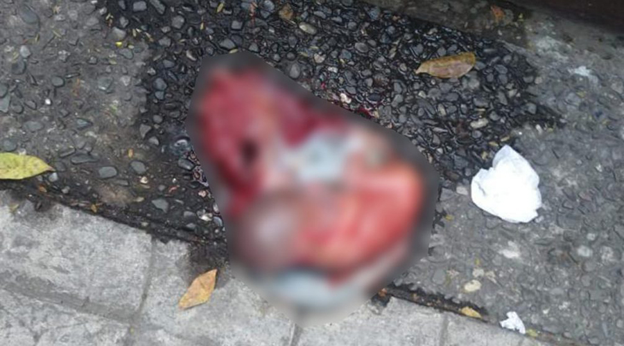 Abandonan feto en un bote de basura en hotel cercano a la Central de Abastos | El Imparcial de Oaxaca