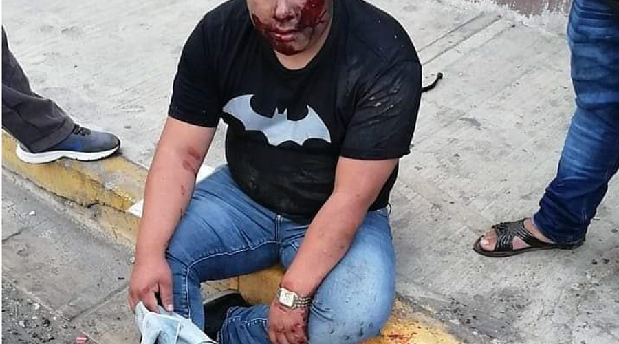 Taquero choca su moto contra auto en calle Nuño del Mercado