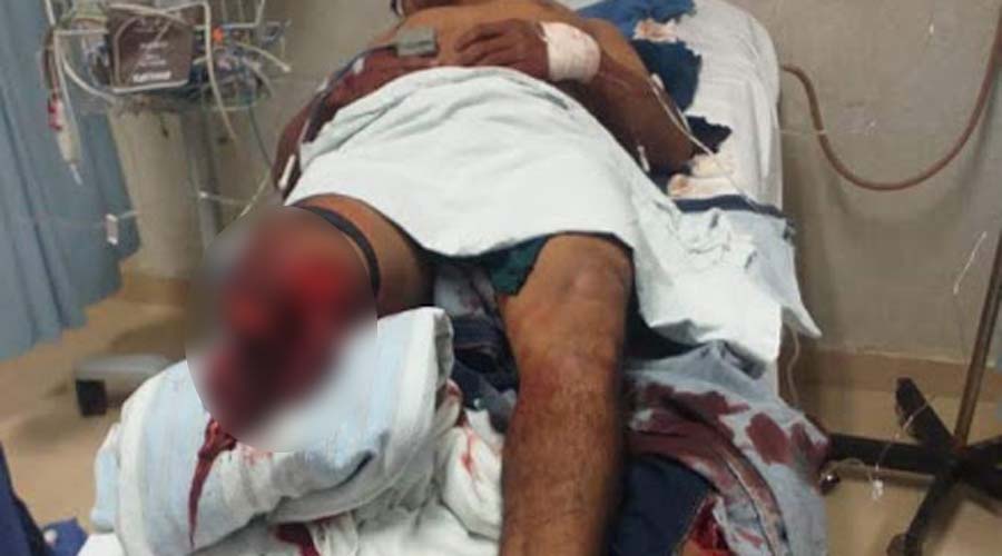 Hombre pierde una pierna en un accidente en moto | El Imparcial de Oaxaca
