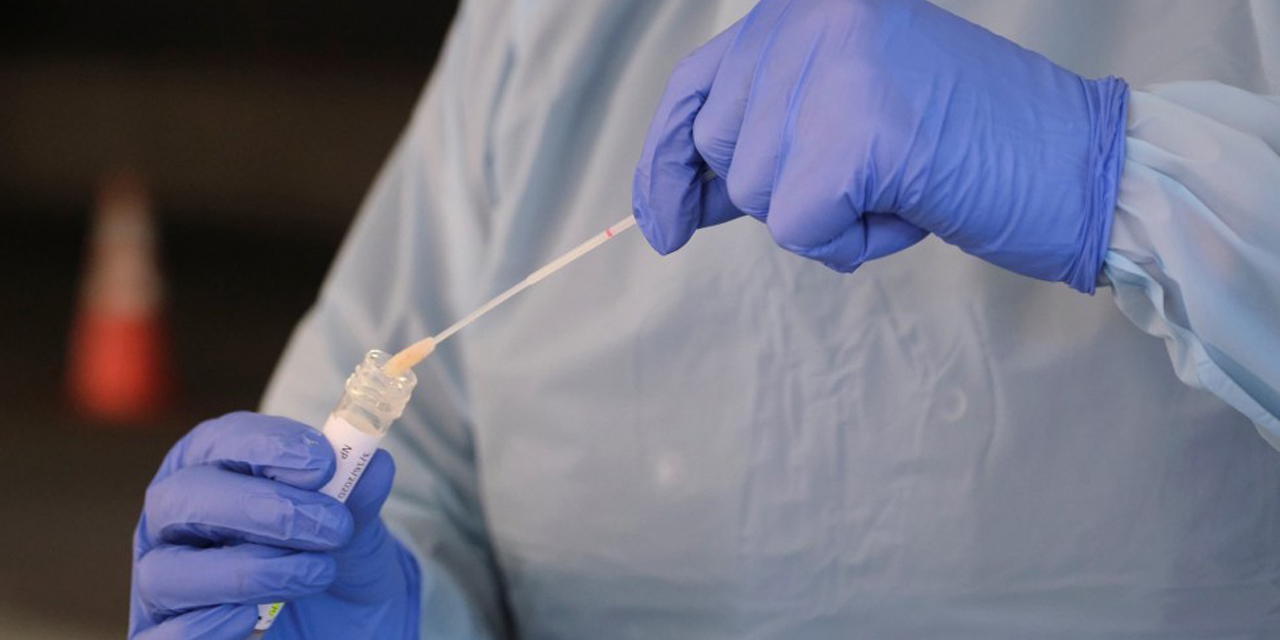 Pruebas de Covid-19 en Oaxaca sólo en laboratorios certificados | El Imparcial de Oaxaca Pruebas de Covid-19 en Oaxaca sólo en laboratorios certificados | El Imparcial de Oaxaca