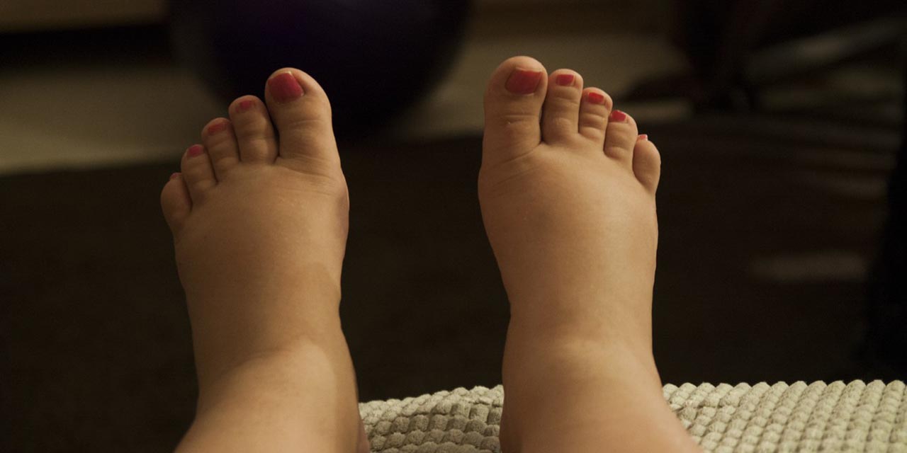 ¿Hinchazón en los dedos de los pies?, señal de posible Covid-19