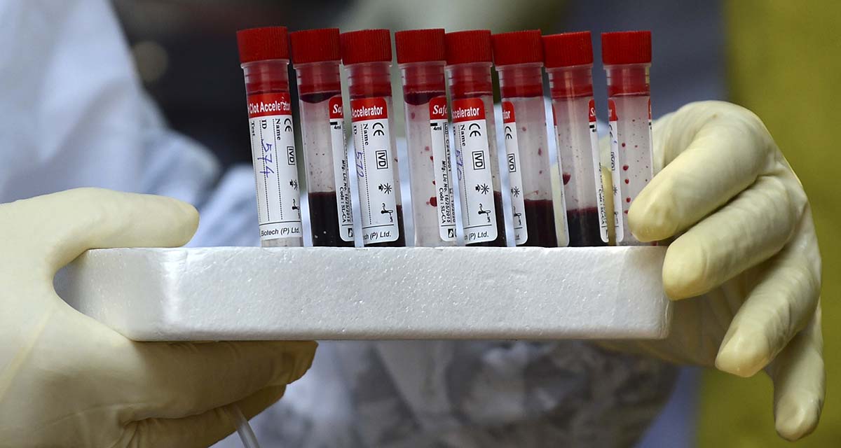 Dan resultados positivos ocho vacunas contra la Covid-19: OMS