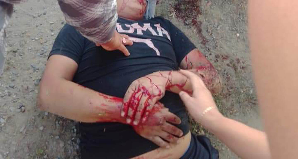¡Brutal impacto entre motociclista y un taxi de Salina Cruz!