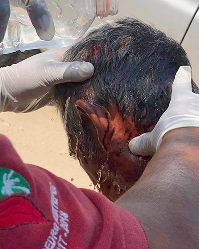 Hombre es atacado a pedradas en Bajos de Chila