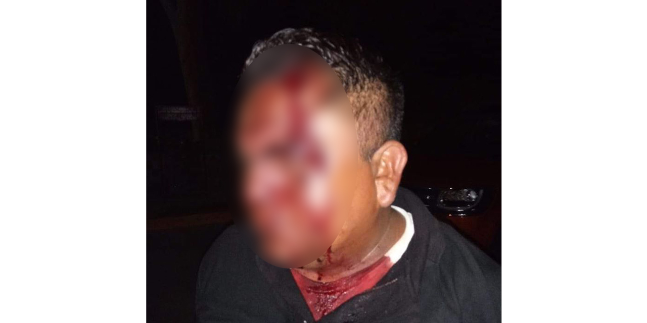 Policías golpean a enfermero en Santiago Astata | El Imparcial de Oaxaca