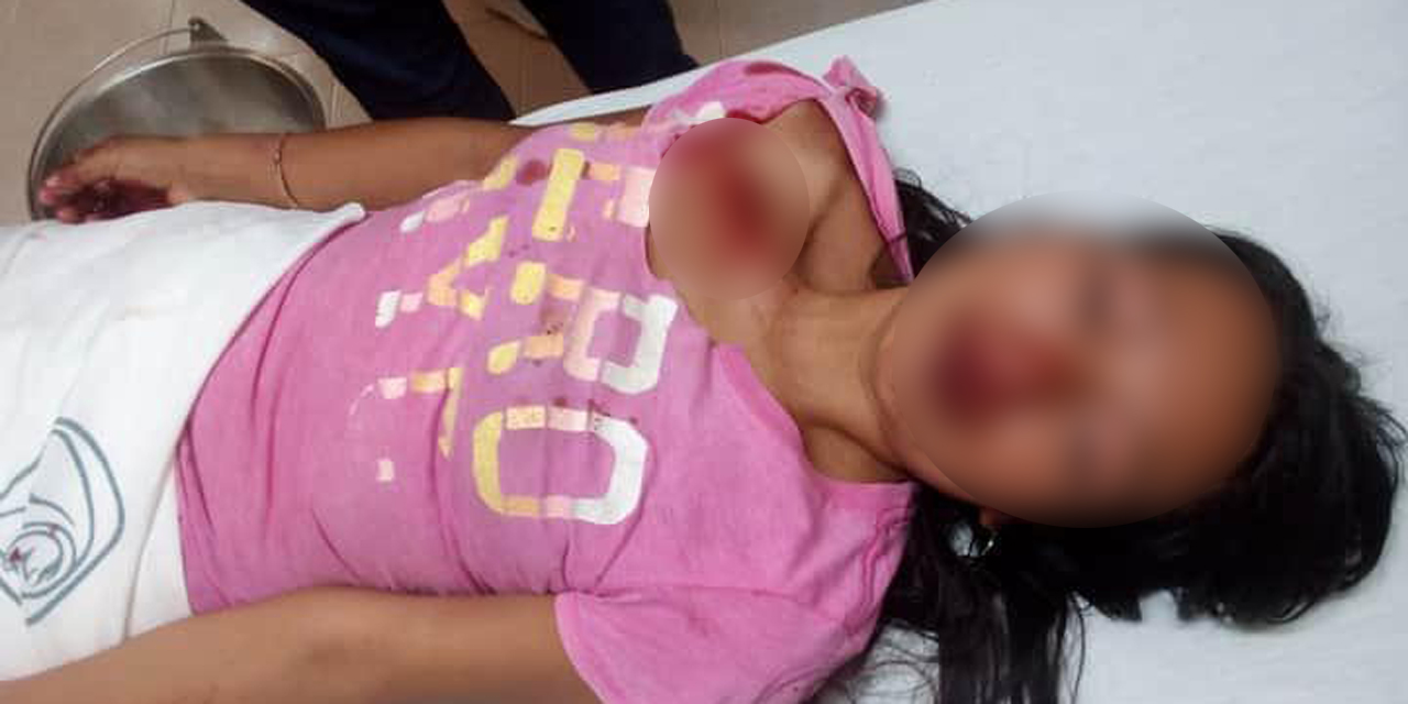 Mujer sufre salvaje golpiza a manos de su pareja en región Mixe | El Imparcial de Oaxaca