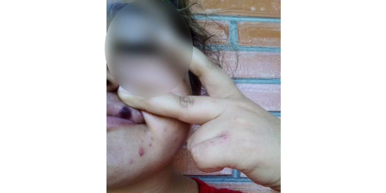 Mujer denuncia agresiones de familiares en Tuxtepec; Visefiscalía no atiende caso | El Imparcial de Oaxaca