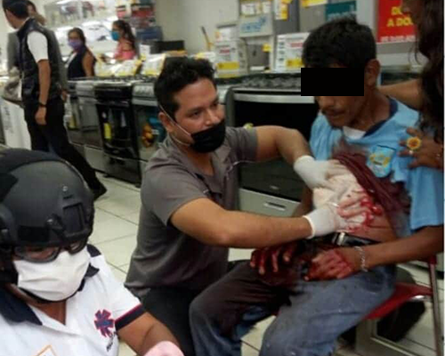 ¡Le sacan los intestinos! Lo atacan en la Central de Abasto | El Imparcial de Oaxaca