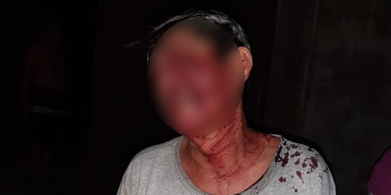 Asaltan y golpean a un hombre en Unión Hidalgo | El Imparcial de Oaxaca