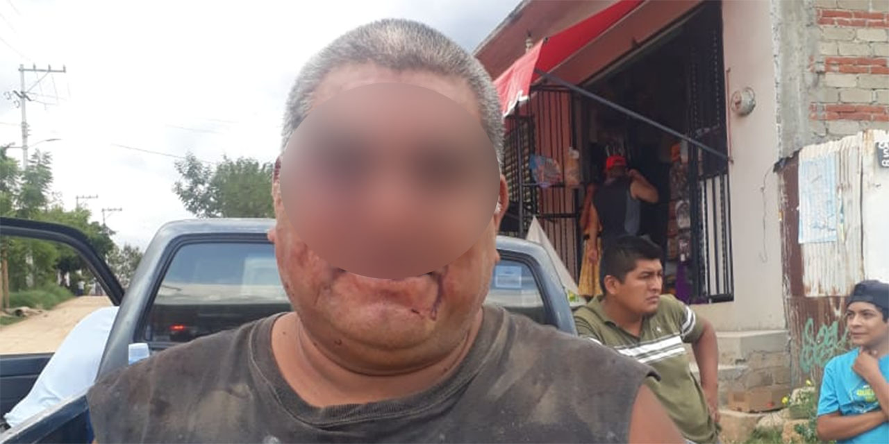Golpean salvajemente a un hombre en Zaachila | El Imparcial de Oaxaca