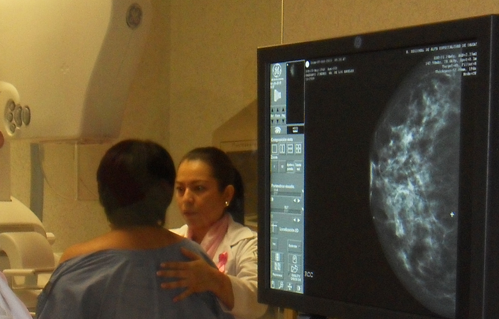 Detección oportuna, clave para hacer frente al cáncer de mama | El Imparcial de Oaxaca