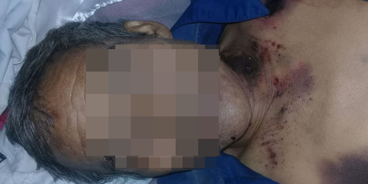 Hallan a un hombre tirado en las Riberas del Atoyac