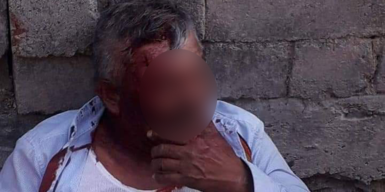 Sufre terrible herida por caída en Tehuantepec