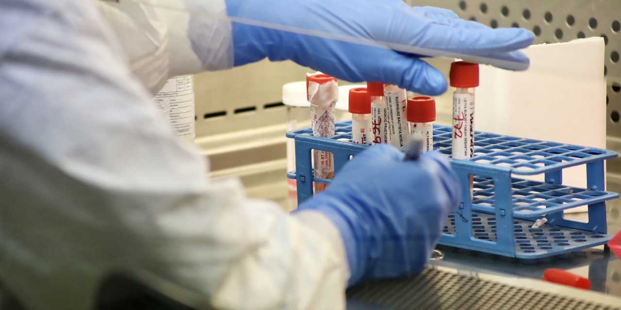 Saturan pacientes laboratorios privados