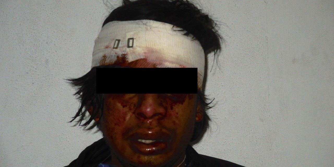Golpean a presunto ladrón en inmediaciones de puente Valerio Trujano