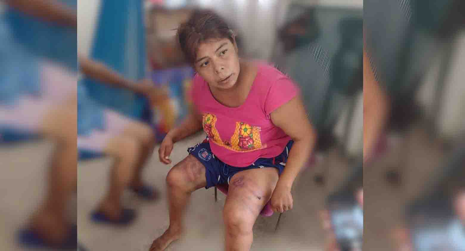 Muere Carolina, víctima de violencia intrafamiliar | El Imparcial de Oaxaca Muere Carolina, víctima de violencia intrafamiliar | El Imparcial de Oaxaca