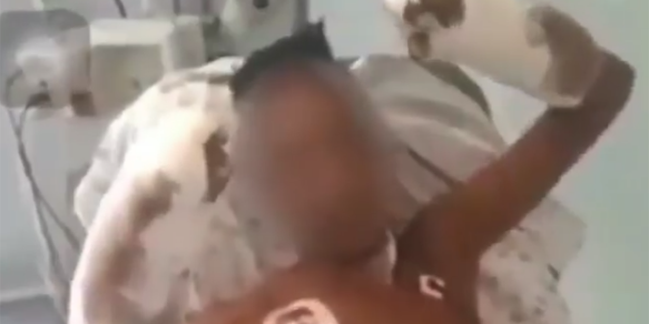 Video: Médicos logran reimplantar la mano amputada de un supuesto ladrón | El Imparcial de Oaxaca Video: Médicos logran reimplantar la mano amputada de un supuesto ladrón | El Imparcial de Oaxaca