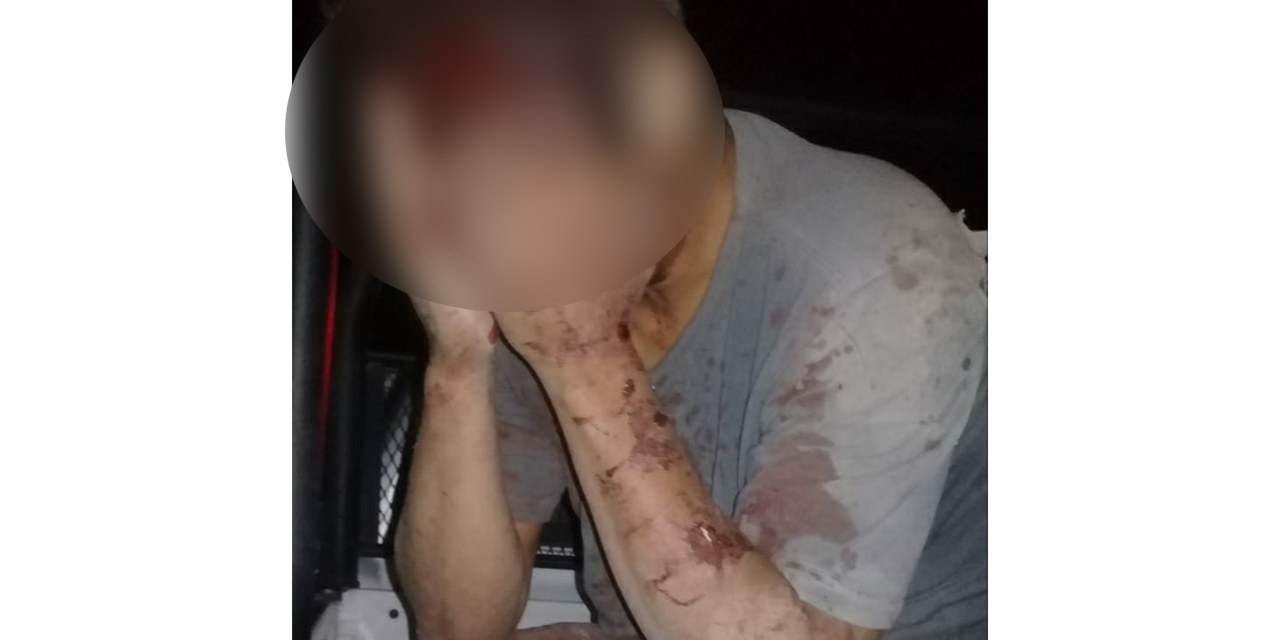 Derrapa motociclista en carretera de Tehuantepec y sufre severas lesiones en el rostro | El Imparcial de Oaxaca