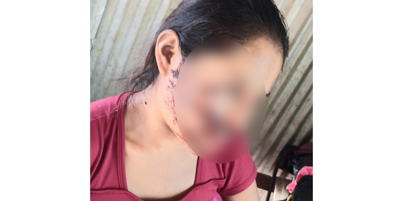 Detienen a un hombre por intento de feminicidio en la región de la Costa | El Imparcial de Oaxaca Detienen a un hombre por intento de feminicidio en la región de la Costa | El Imparcial de Oaxaca