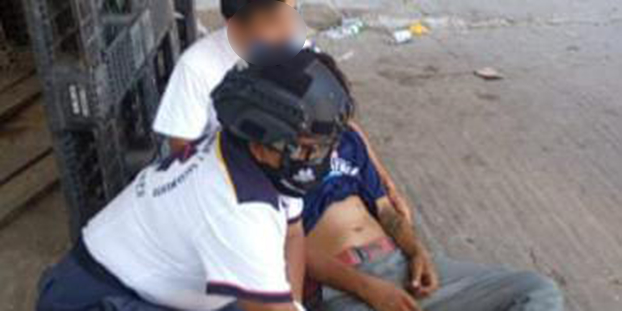 Atacan a navajazos a un joven en la Central de Abasto