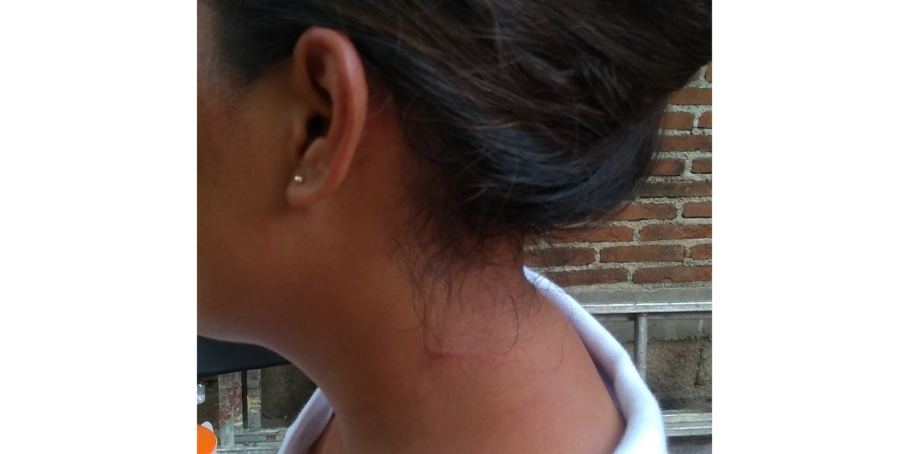 Violentan a mujeres en Día Naranja durante elecciones de bienes comunales en Santa María Tonameca | El Imparcial de Oaxaca