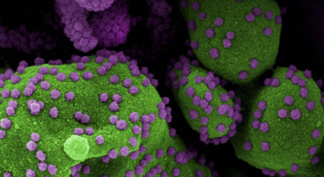 Reclaman científicos nueva investigación sobre origen del coronavirus | El Imparcial de Oaxaca
