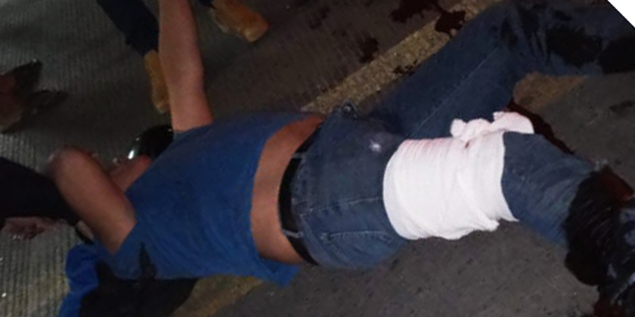 Motociclista se fractura la pierna en accidente en Santa Anita | El Imparcial de Oaxaca