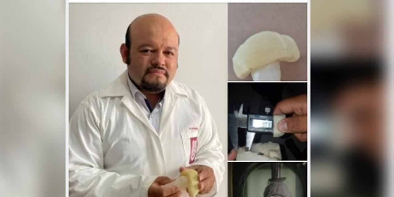 IPN desarrolla una prótesis a base de polímeros para cadera | El Imparcial de Oaxaca