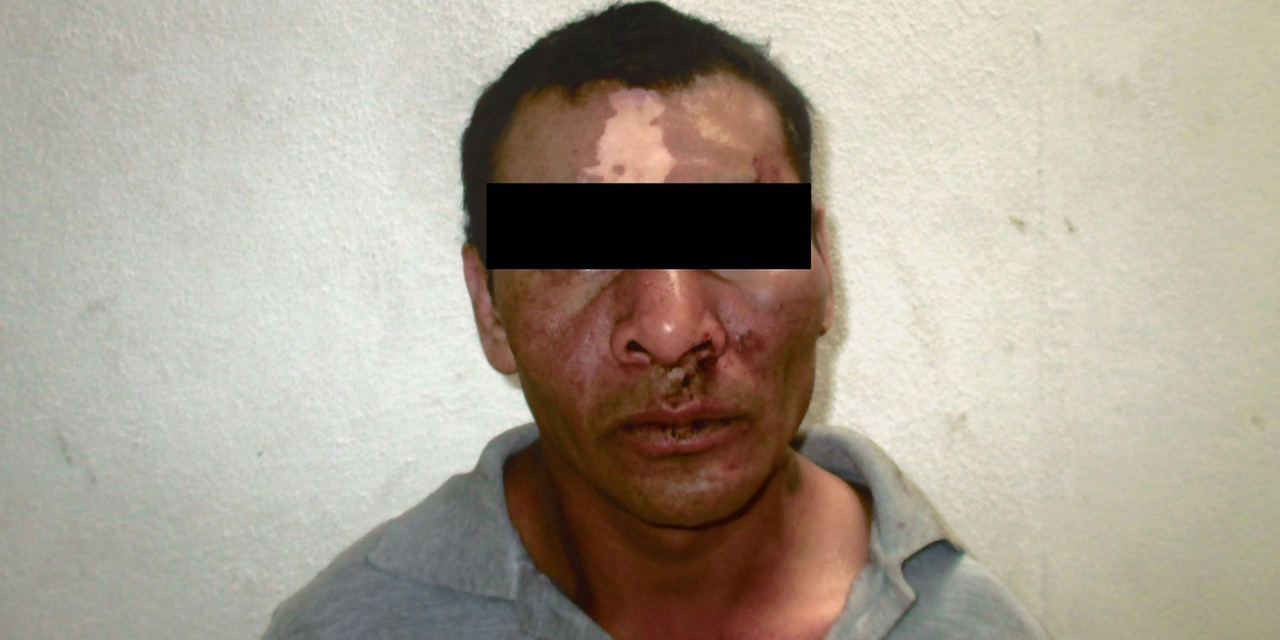 Ataca a golpes a su familia en la Colonia Solidaridad | El Imparcial de Oaxaca Ataca a golpes a su familia en la Colonia Solidaridad | El Imparcial de Oaxaca