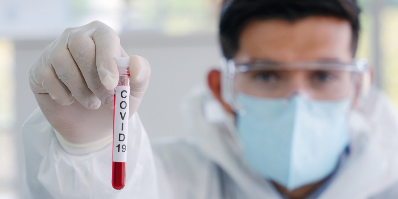 OMS cree en la hipótesis de que coronavirus fue causa de fuga de un laboratorio