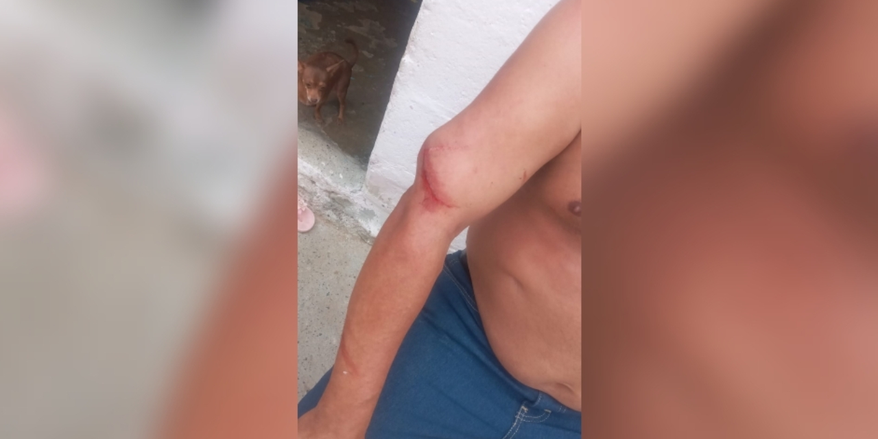 Agreden con machete a masculino | El Imparcial de Oaxaca