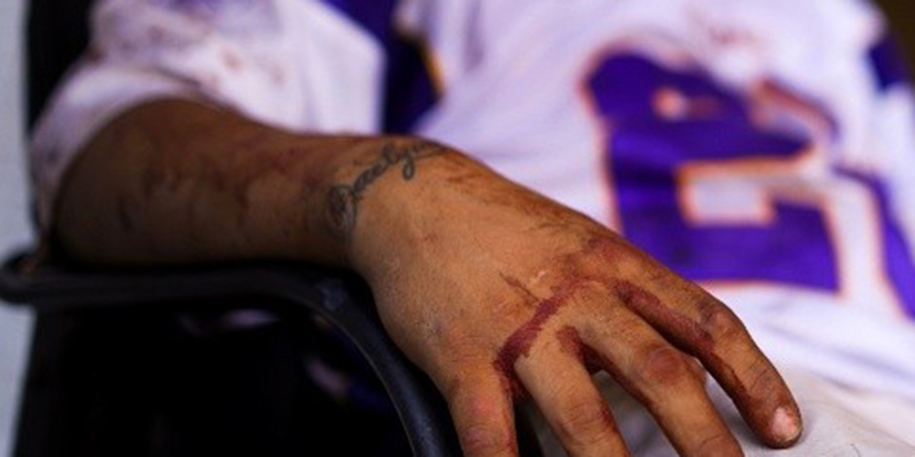 Le propinan paliza a un hombre en Huajuapan | El Imparcial de Oaxaca Le propinan paliza a un hombre en Huajuapan | El Imparcial de Oaxaca