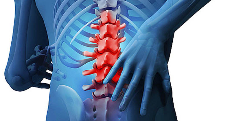 Dolor de ciática: Centro de la Columna Vertebral habla de mitos y realidades | El Imparcial de Oaxaca Dolor de ciática: Centro de la Columna Vertebral habla de mitos y realidades | El Imparcial de Oaxaca