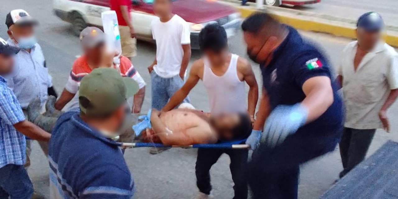 Se tritura el brazo en accidente en Etla | El Imparcial de Oaxaca