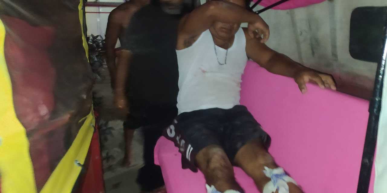 Lo balean en Juchitán; queda herido en las piernas | El Imparcial de Oaxaca