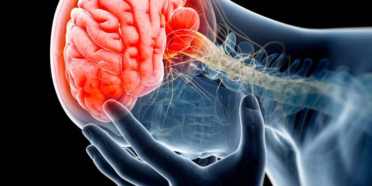¿Qué es un derrame cerebral y cuáles son los síntomas?, aquí te lo decimos | El Imparcial de Oaxaca