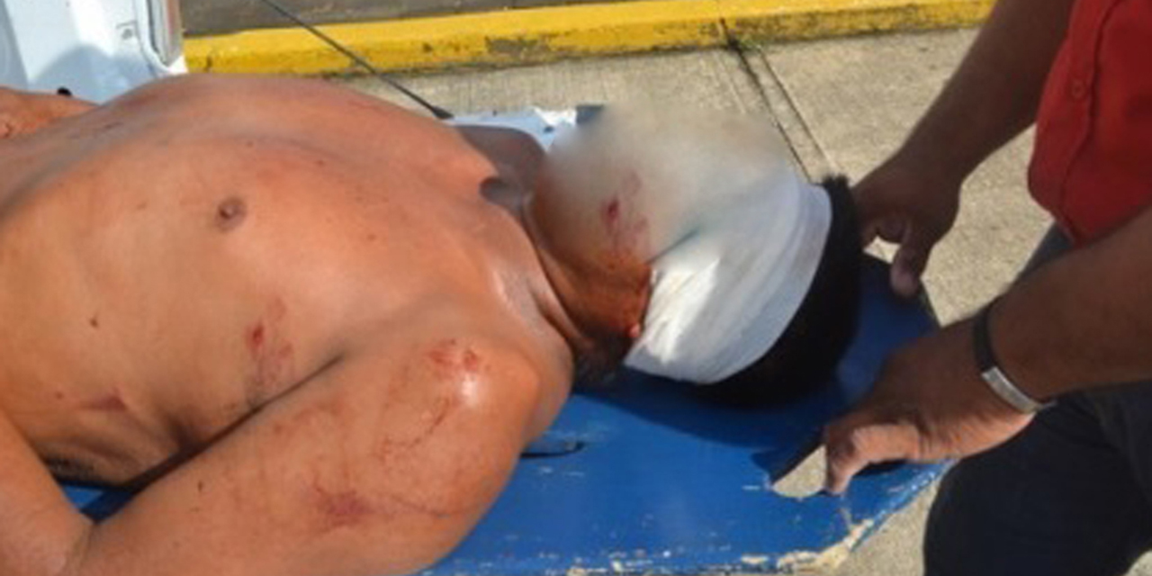 Lo hallan desnudo y brutalmente golpeado | El Imparcial de Oaxaca