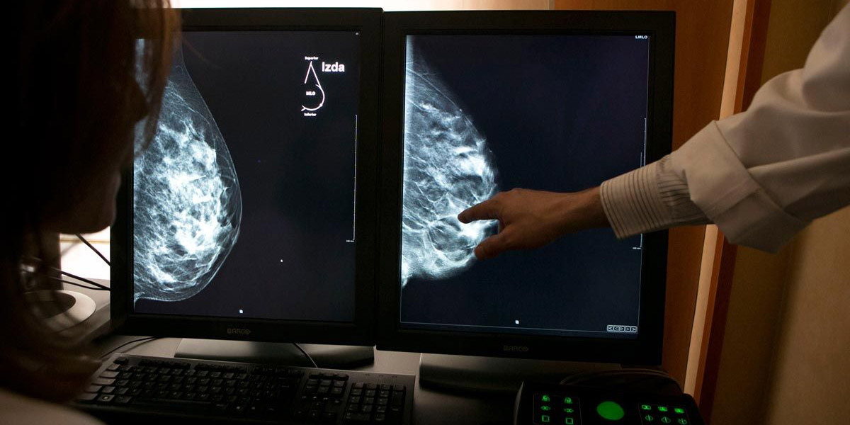 Un grupo de investigadores previenen en ratones la reaparición de un cáncer de mama más agresivo | El Imparcial de Oaxaca