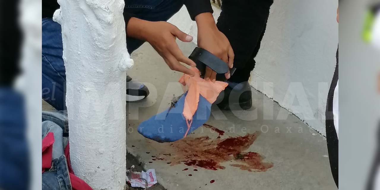 ¡ÚLTIMA HORA! Atacan con arma de fuego a motociclista en San Martín Mexicápam