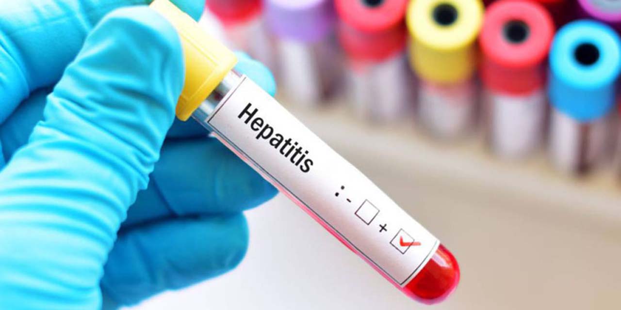 Registran cinco casos de hepatitis A en 2022 | El Imparcial de Oaxaca