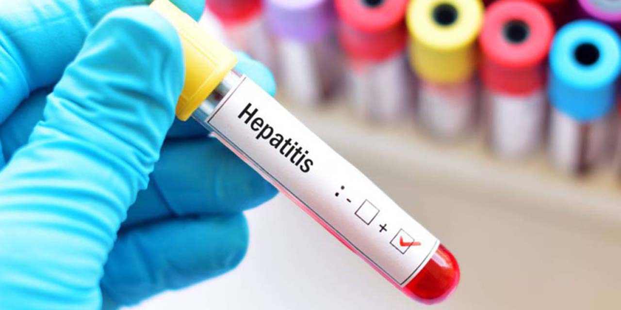 Registran cinco casos de hepatitis A en 2022