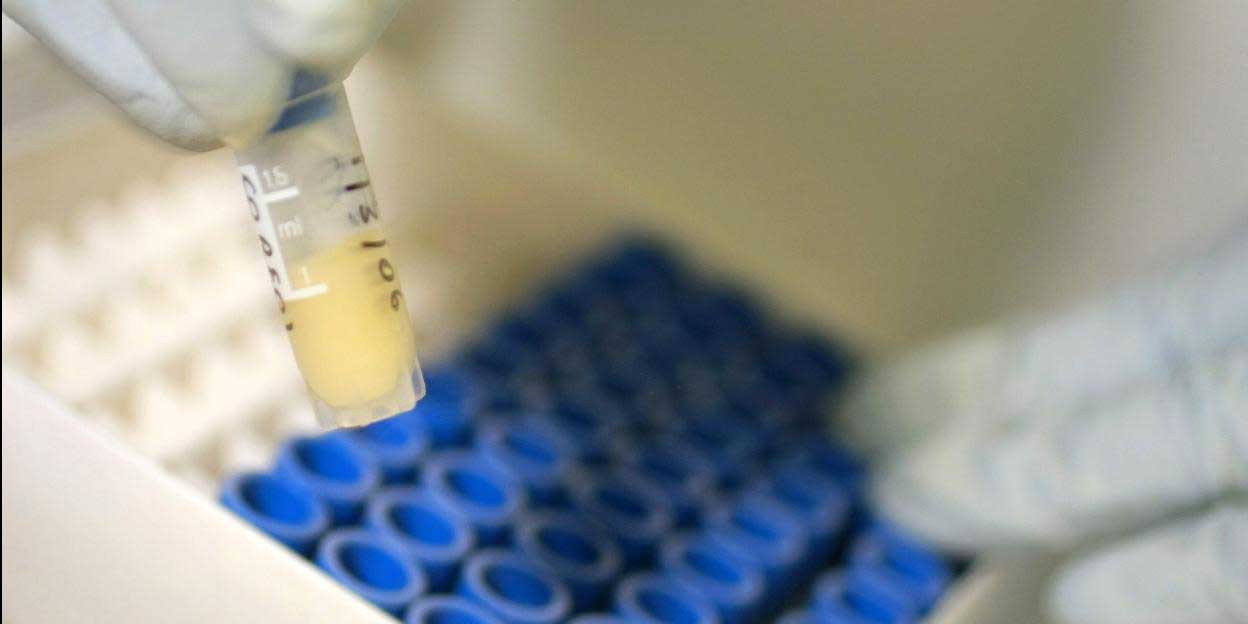 Descubierta una nueva variante del VIH más contagiosa y virulenta