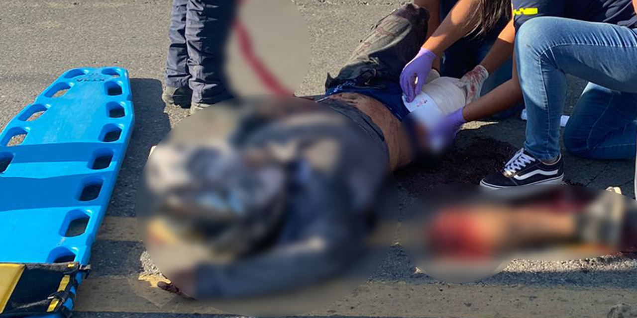 Hombre pierde la pierna en brutal accidente | El Imparcial de Oaxaca