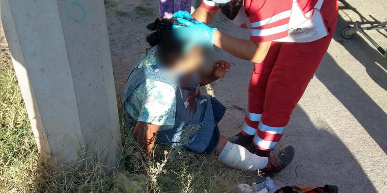 Perro ataca y lesiona a septuagenaria | El Imparcial de Oaxaca