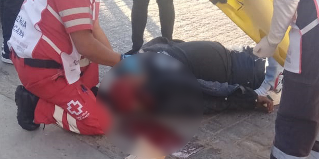 Pierde el control y se estrella contra objeto fijo