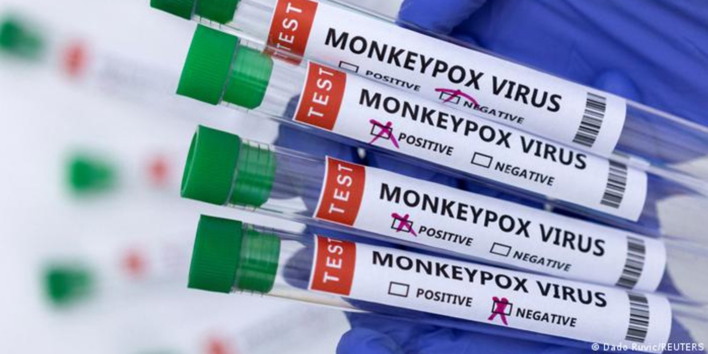 Argentina confirma su primer caso de viruela del mono | El Imparcial de Oaxaca