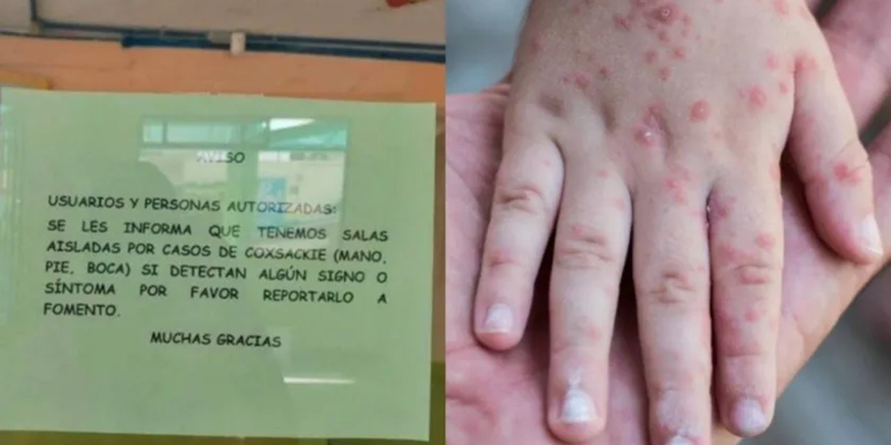Qué es el virus Coxsackie que está alertando a guarderías del IMSS y cuáles son sus síntomas | El Imparcial de Oaxaca