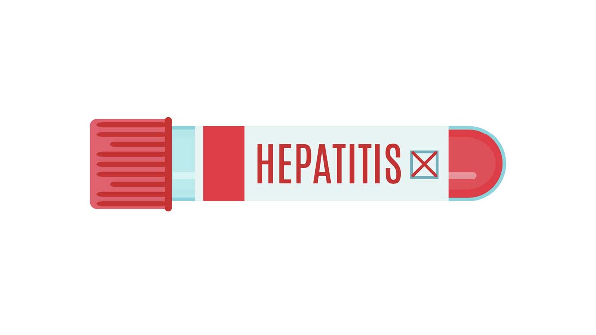 Hepatitis aguda infantil, todo lo que debes saber, OPS responde | El Imparcial de Oaxaca