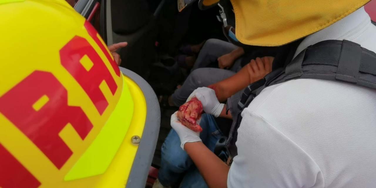 Ataca pitbull a una mujer; la deja malherida de un brazo | El Imparcial de Oaxaca