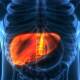 Vida saludable: Hígado graso